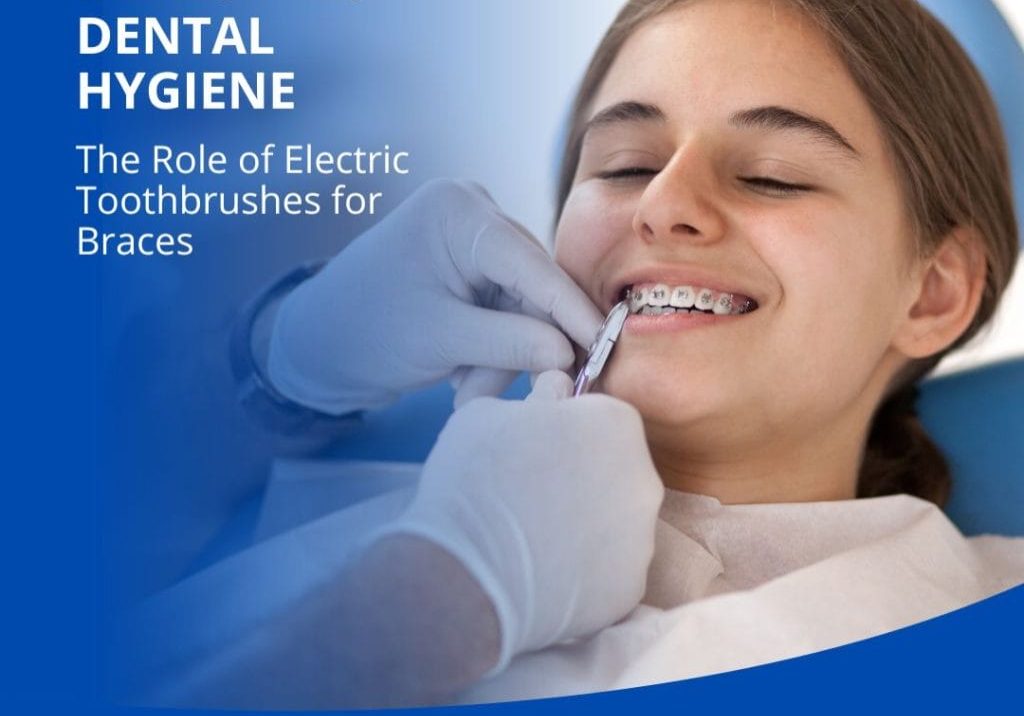 The Role of Electric Toothbrushes for Braces